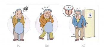 小便次数多老感觉想尿这是什么原因